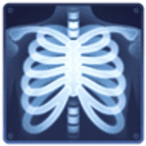 Röntgenbild - Facebook